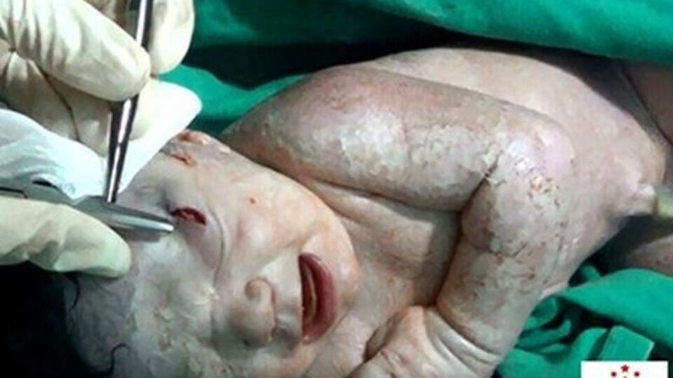 Осколок не задел органы зрения