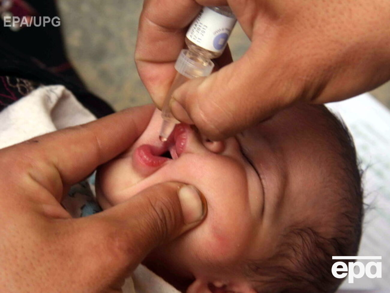 В министерстве заявили, что в Украине наблюдается вспышка полиомиелита из-за отсутствия прививок