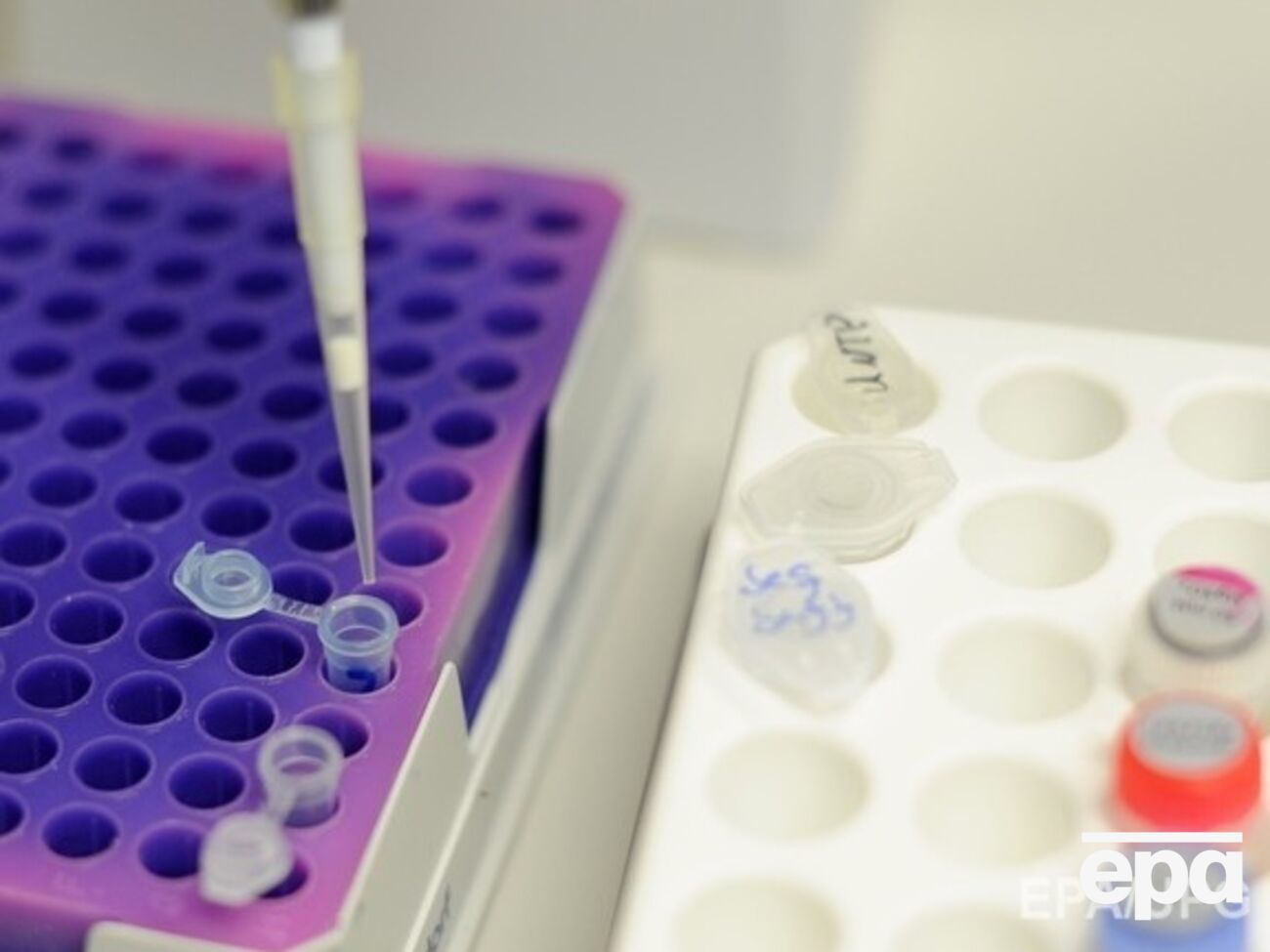 Результаты исследования могут помочь бороться с врожденными болезнями