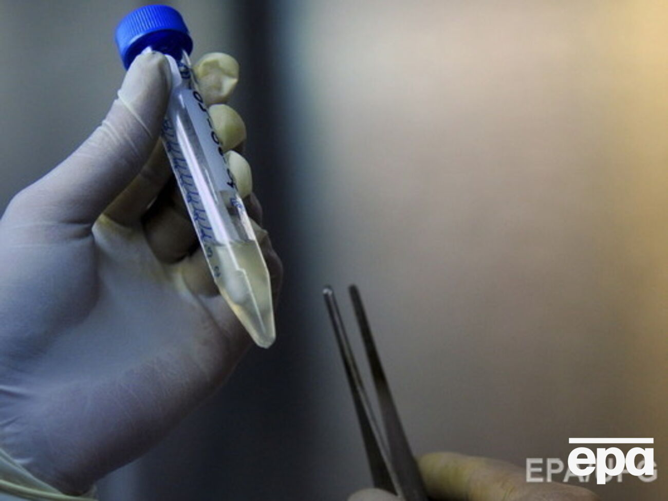 В Ивано-Франковске объявлен карантин