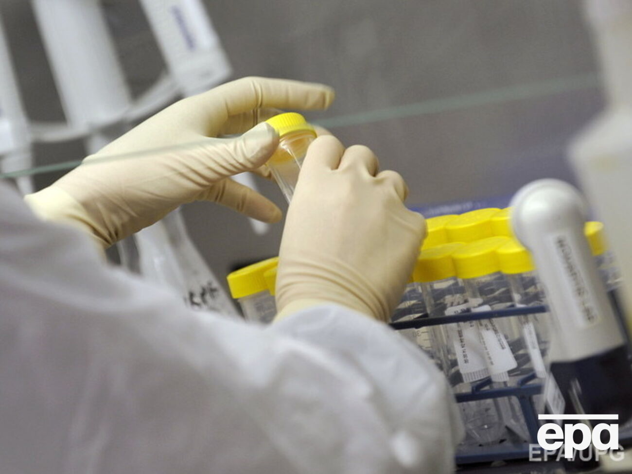 В Украине от гриппа умерли 72 человека