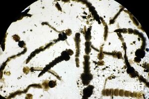 ВОЗ прогнозирует заражение 3–4 млн человек вирусом Зика