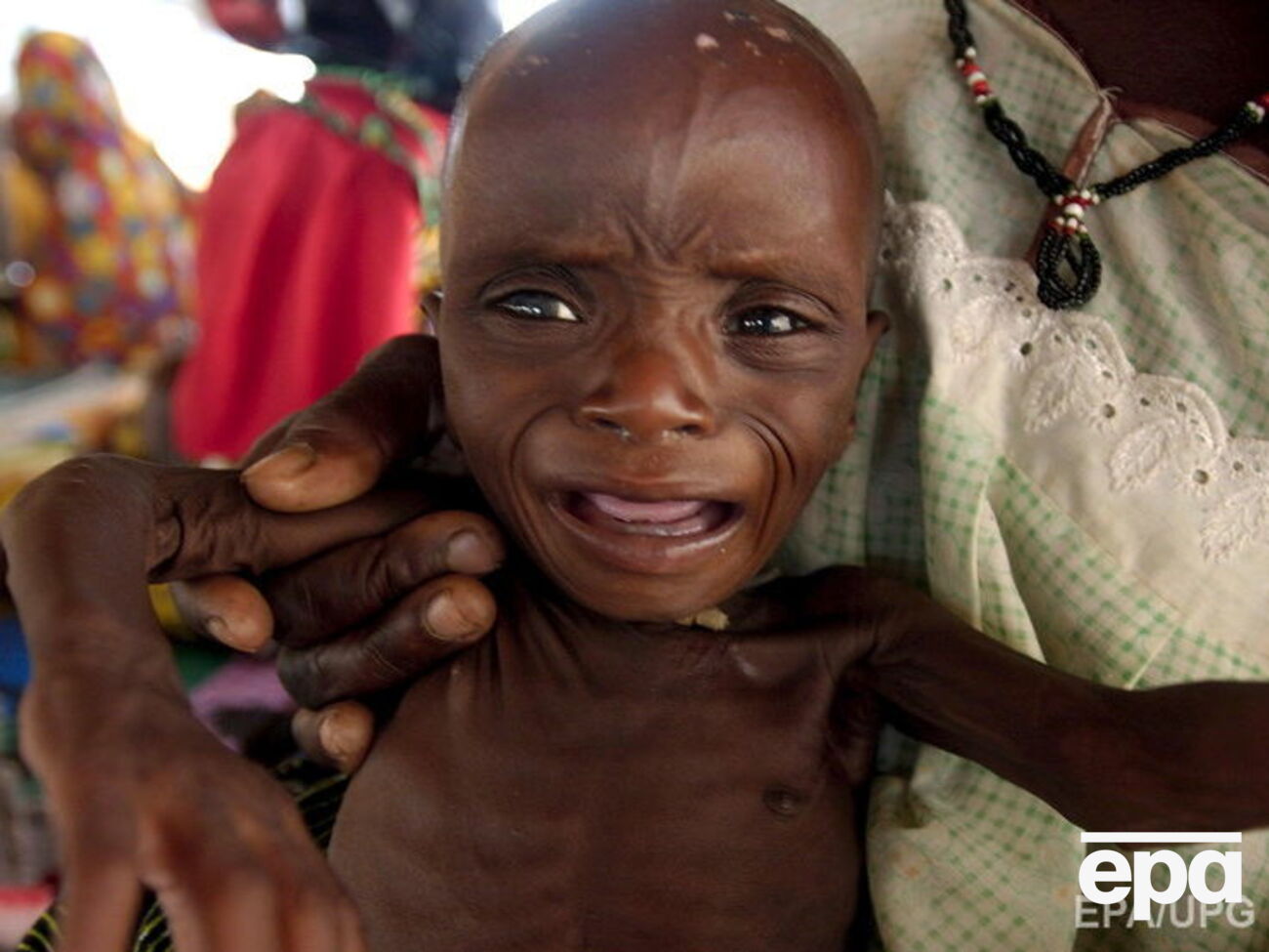 В ООН предупредили о десятках тысяч голодающих детей Африки