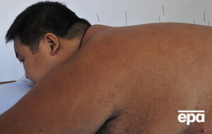 Израильские ученые работают над препаратами для лечения рецидивирующего ожирения