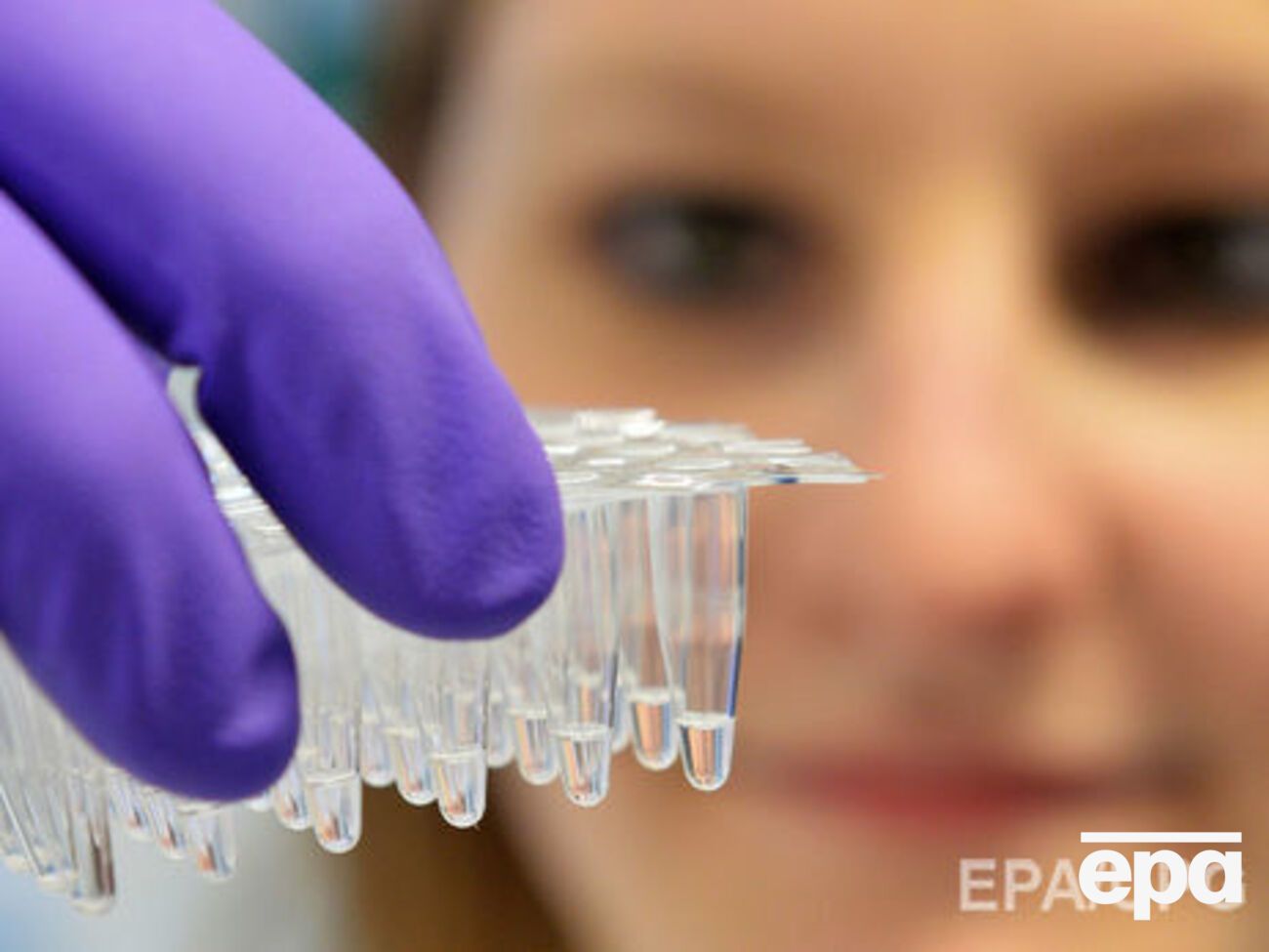 Все четверо умерших были в группе риска