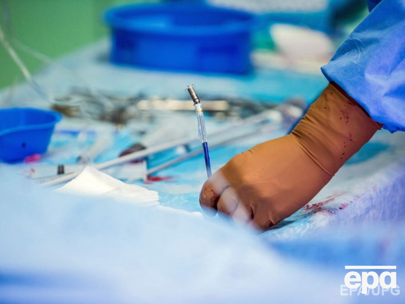 В клинике готовятся к исторической трансплантации