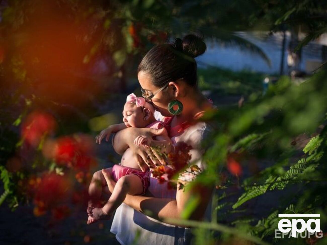 Вирус Зика у беременной женщины может вызвать микроцефалию у ребенка