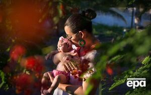 Вирус Зика у беременной женщины может вызвать микроцефалию у ребенка