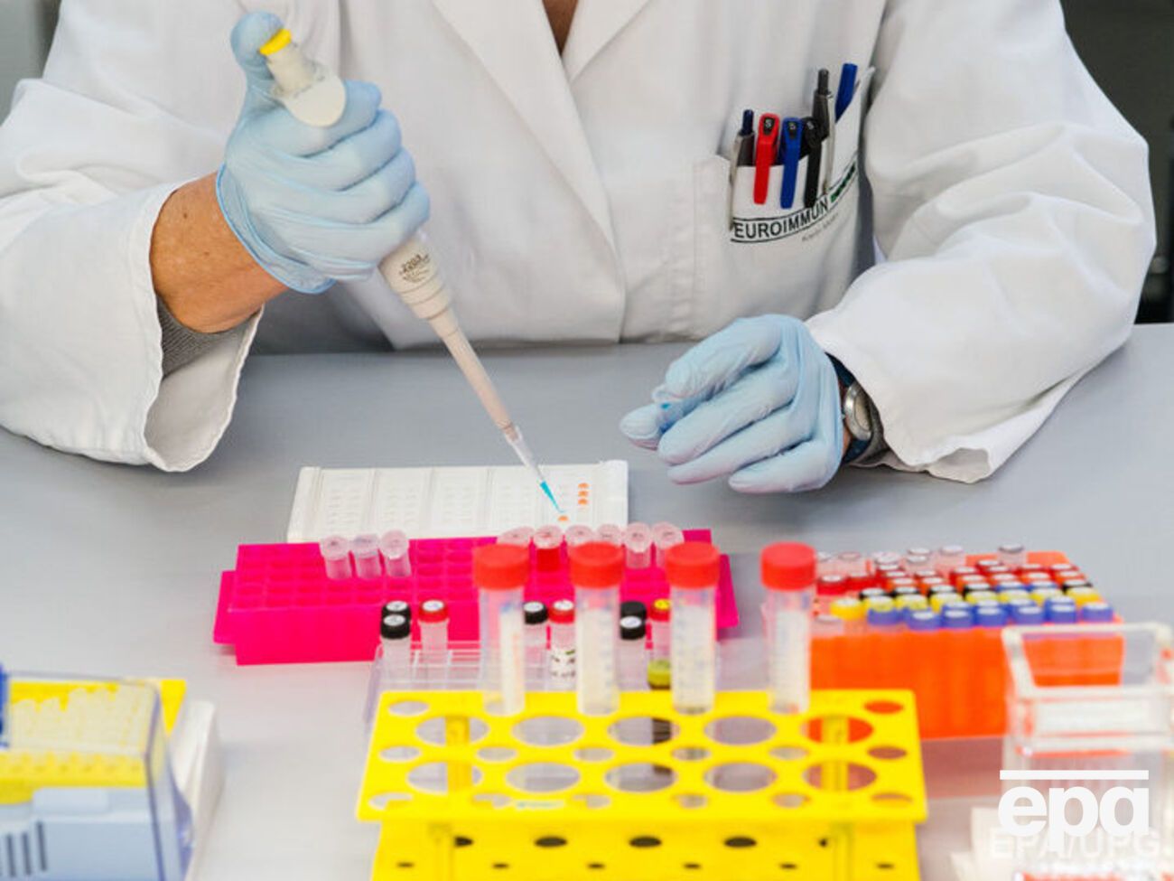 В Китае медики выделили&nbsp;два штамма вируса Зика из образцов крови и мочи двух пациентов