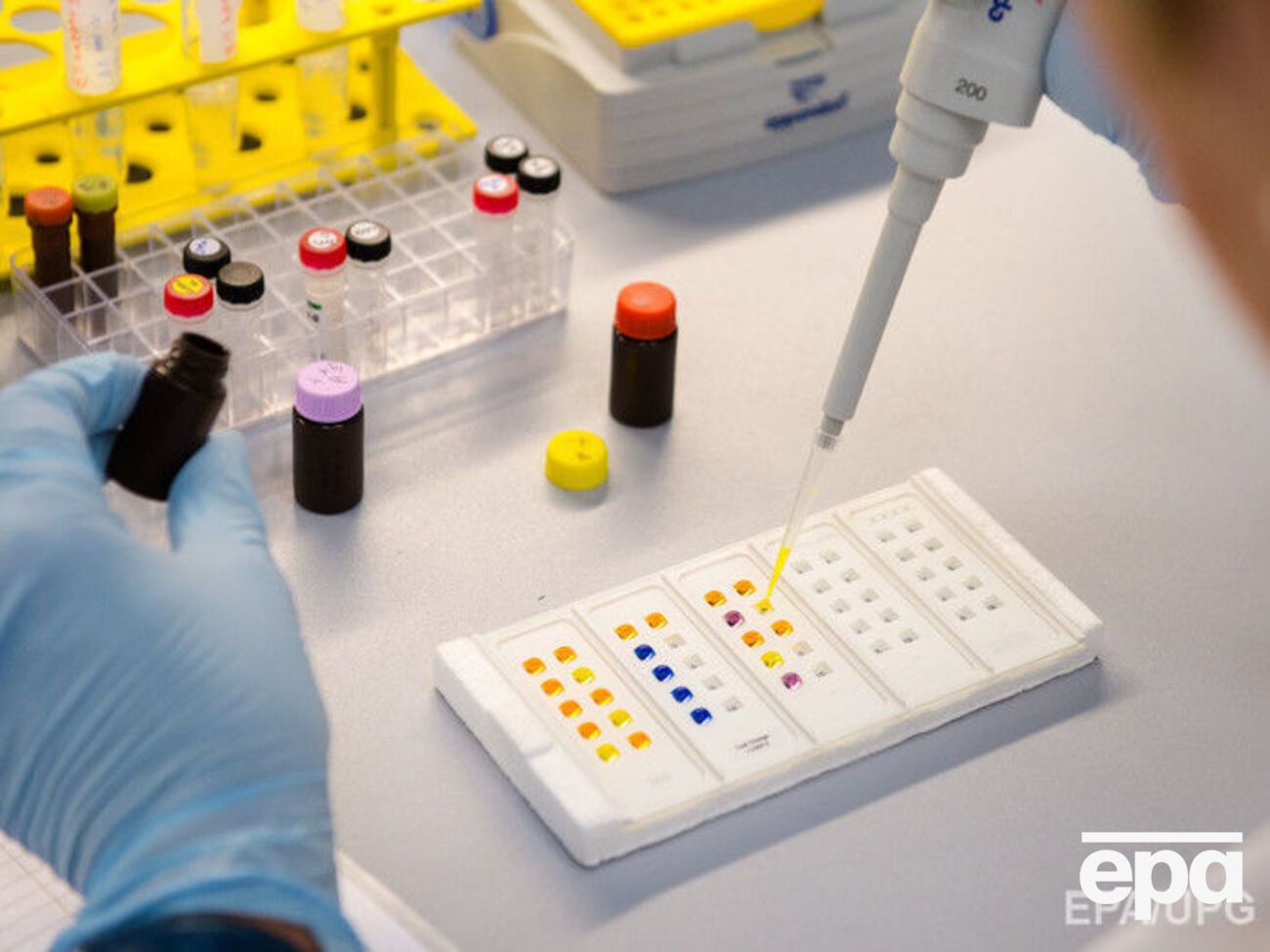 Во Франции зарегистрировали первый случай заражения вирусом Зика через сексуальный контакт