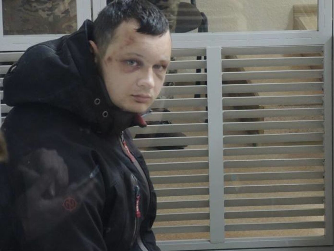 Врачи подозревают у Краснова сотрясение мозга