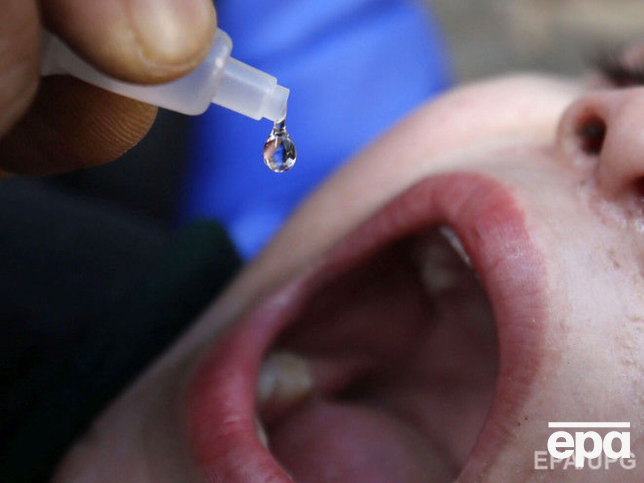 Медики уверяют, что вероятность переболеть полиомиелитом в результате вакцинации&nbsp;&ndash; 1 на 17 млн