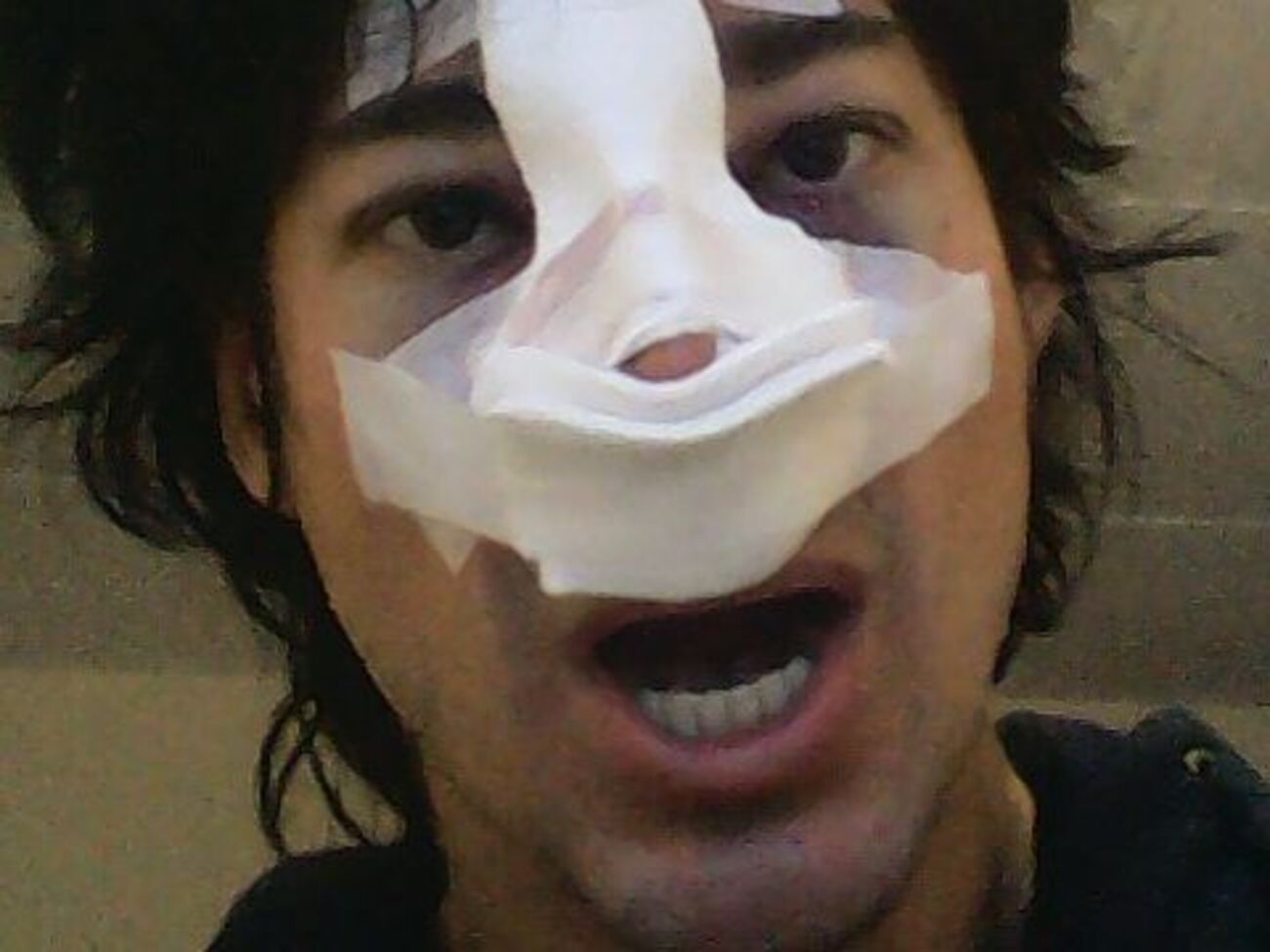 Алибасов: Все-таки солист группы "На-На" Леня Семидьянов нашел себе приключение на жо..., ой, на нос!