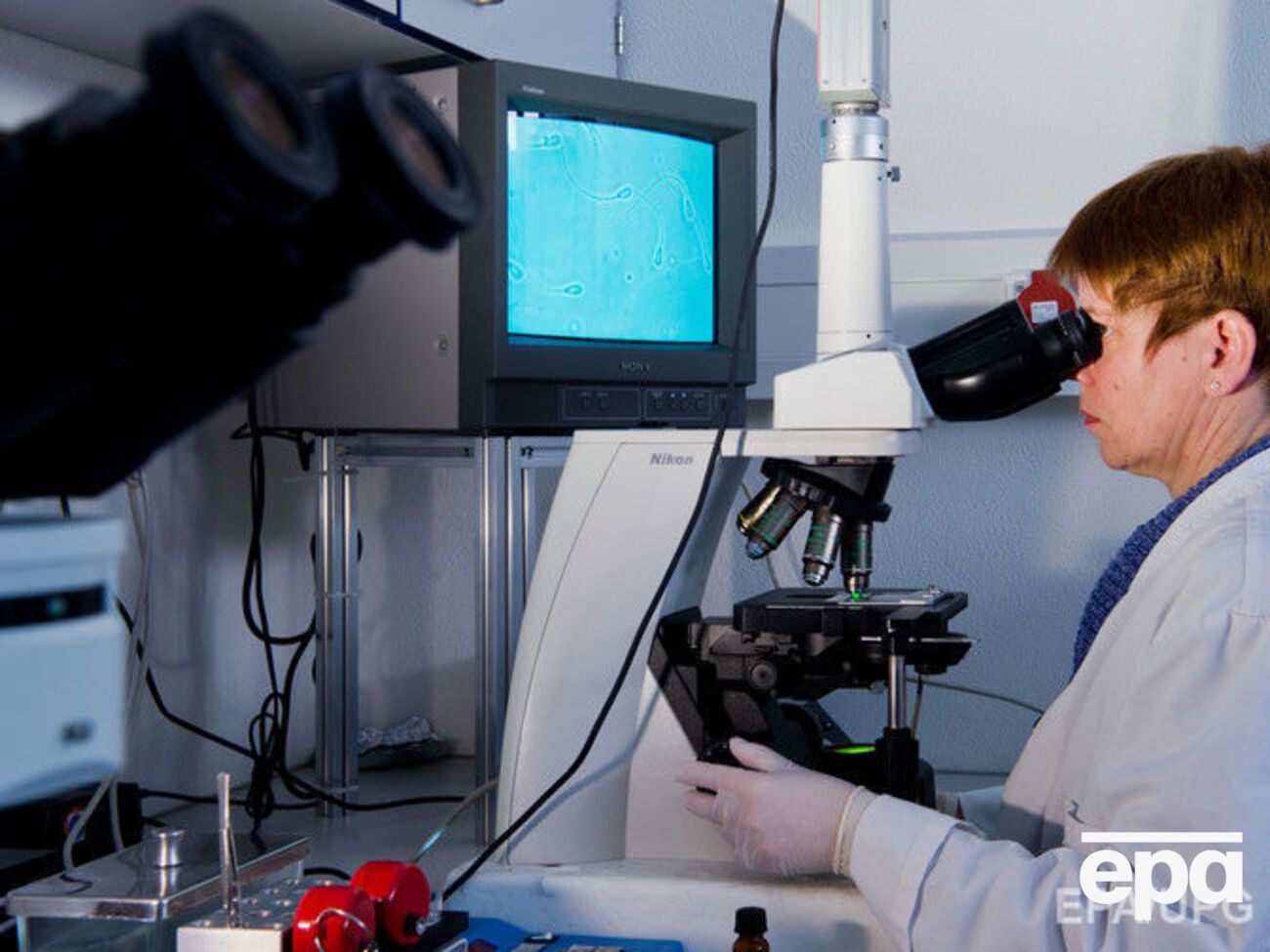 Ученым удалось удалить ВИЧ из генома