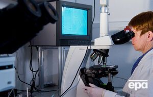 Ученым удалось удалить ВИЧ из генома