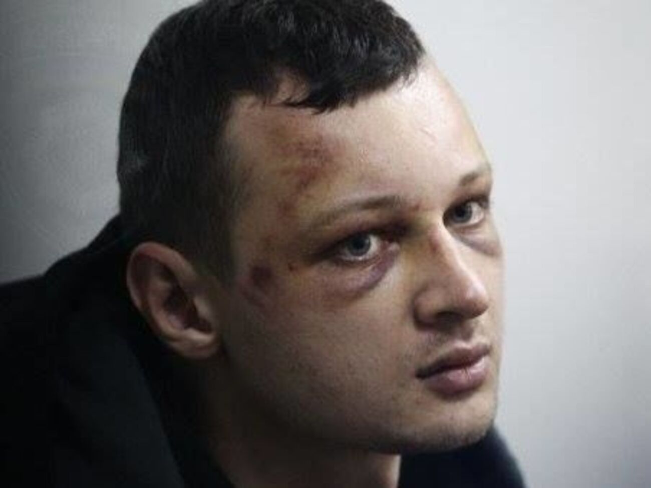 Краснов уже около суток находится в реанимации