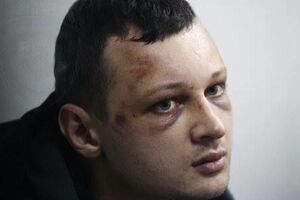 Краснов уже около суток находится в реанимации