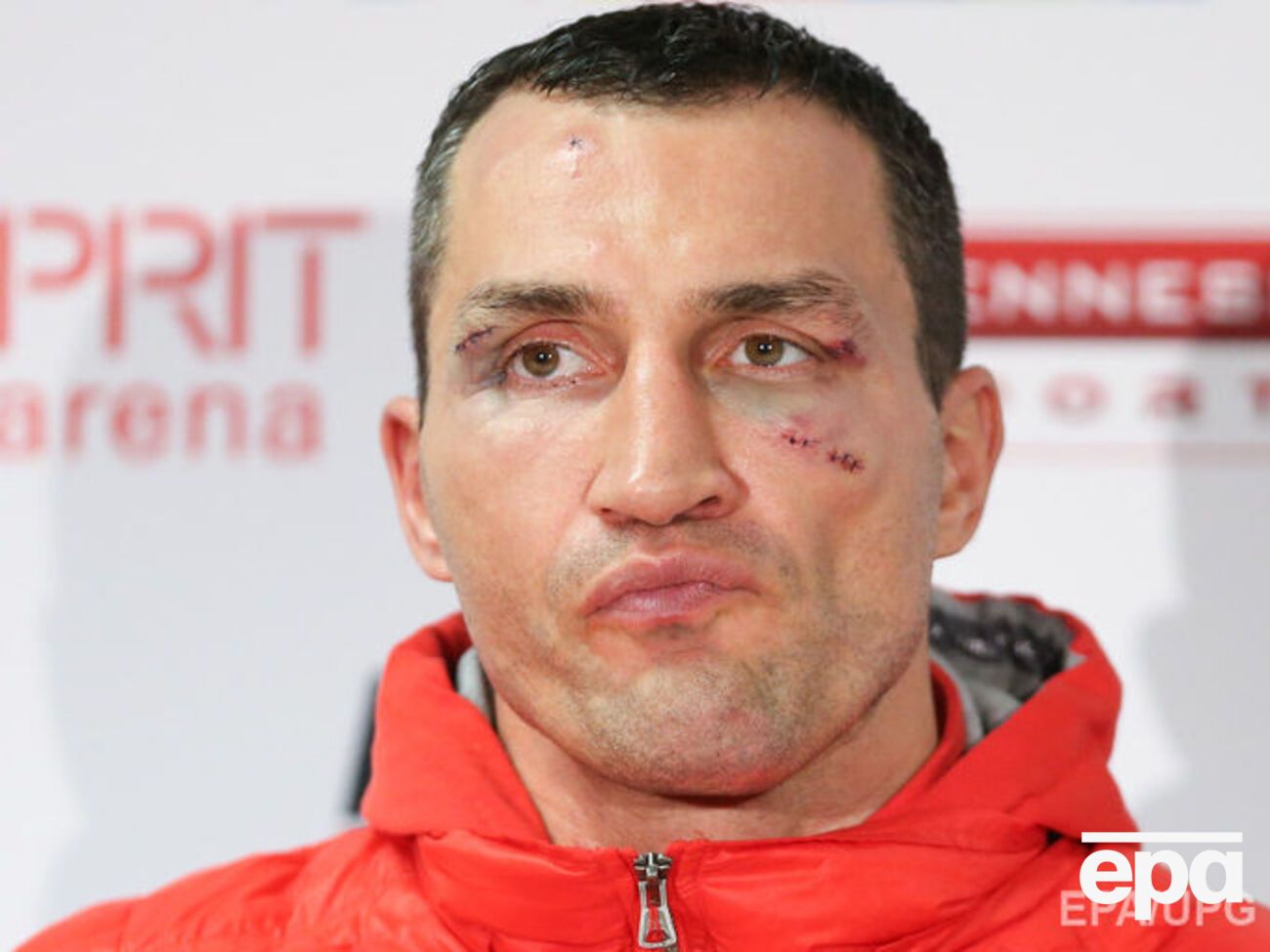 Кличко сообщил, что переговоры о бое с Фьюри еще ведутся