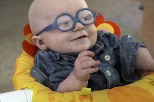 Мальчик-альбинос впервые отреагировал на свою маму