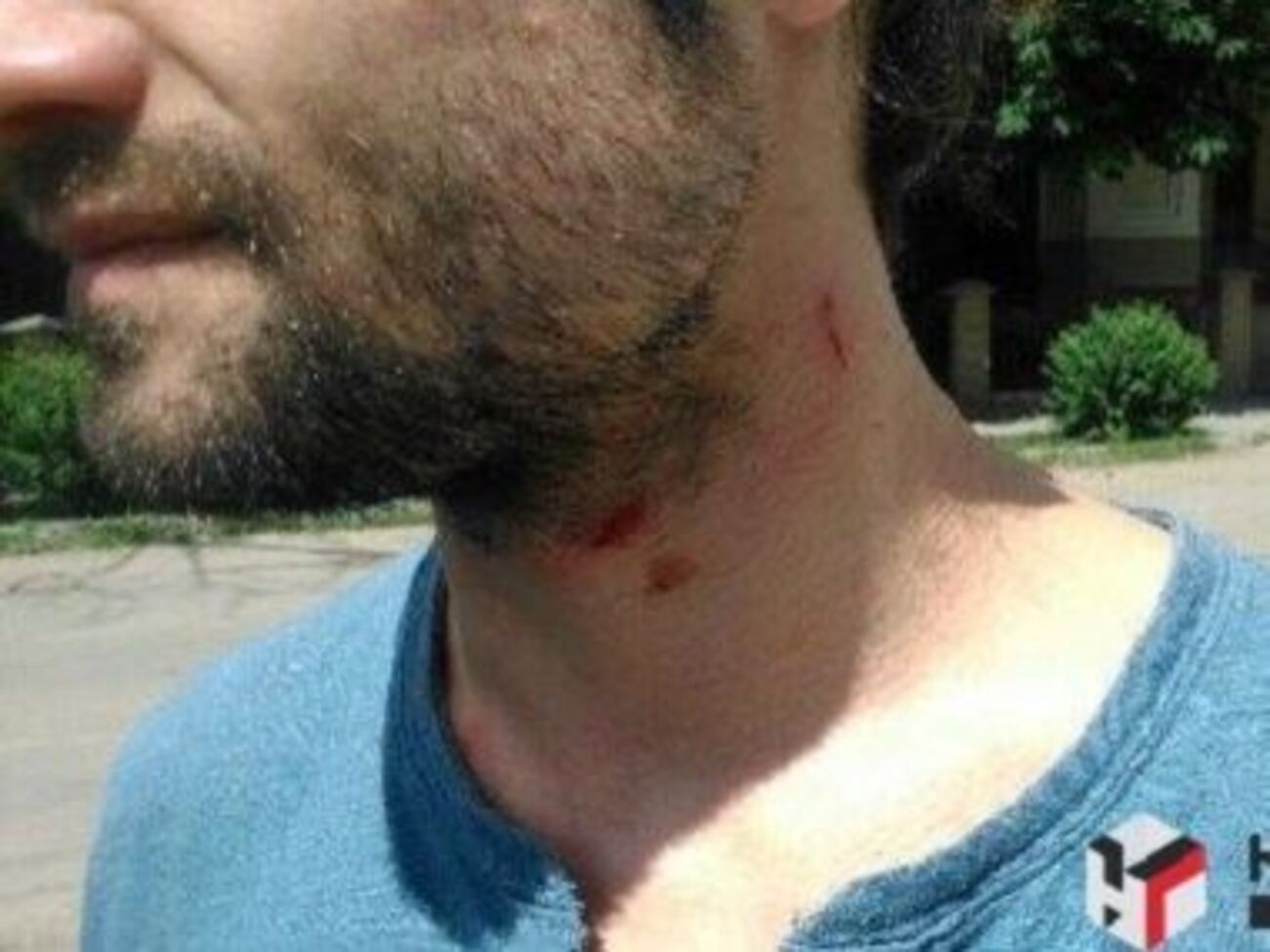 Нападавший, по словам журналистов, схватил оператора за одежду и стал душить