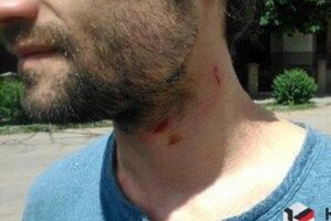 Нападавший, по словам журналистов, схватил оператора за одежду и стал душить