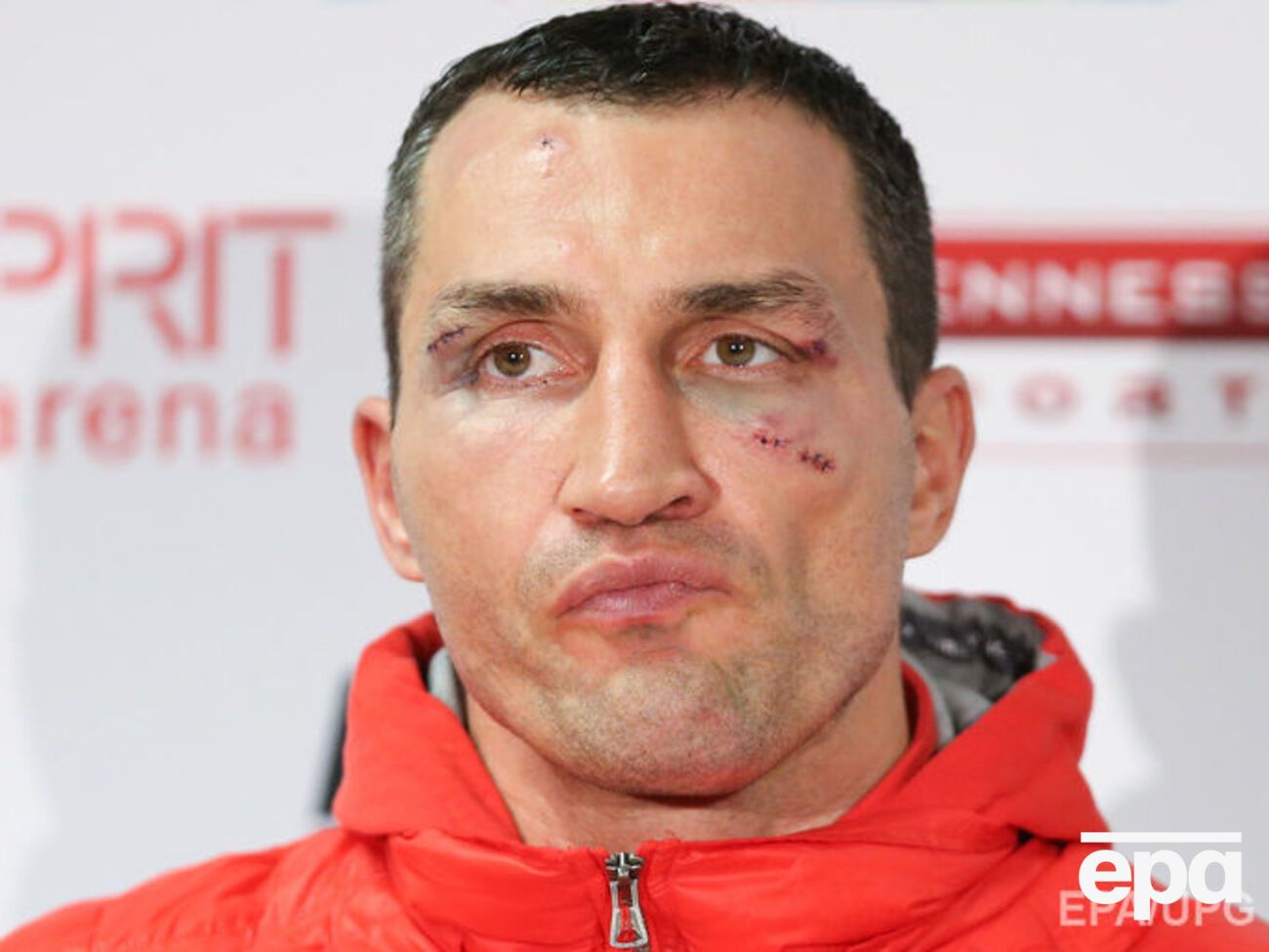 Кличко начал подготовку к июльскому поединку против Фьюри