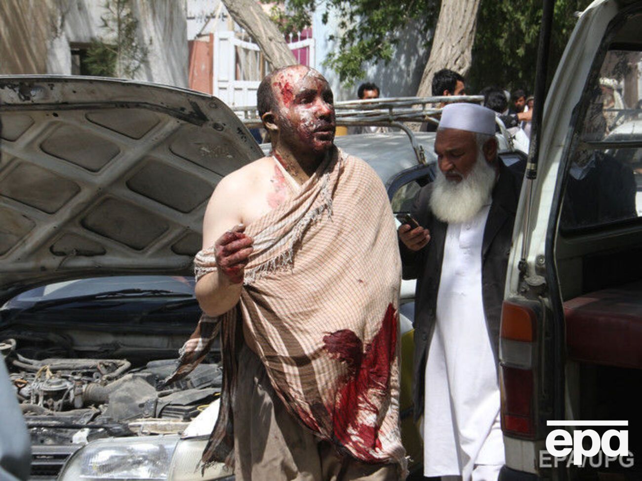 Один из раненых в результате автокатастрофы