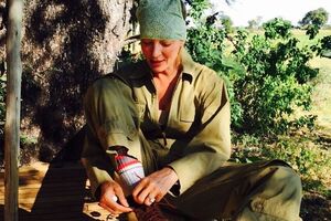 Турман показала, как выглядит после полученных травм