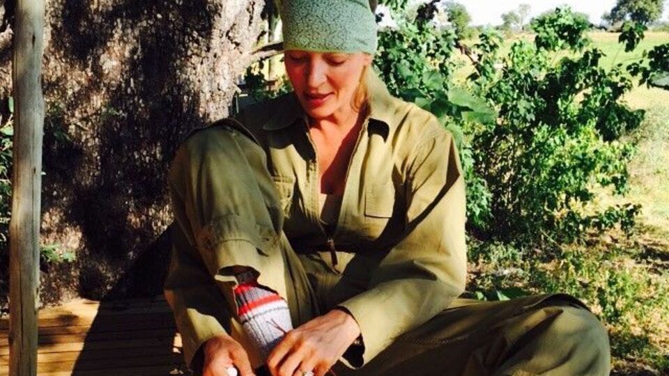 Турман показала, как выглядит после полученных травм