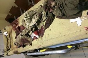 Тарас Чмут: Два раненных морпеха. По огромной тупости государства