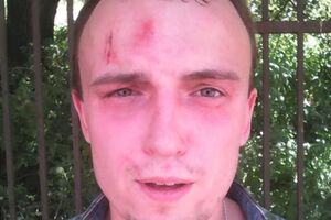 Денис Полищук после того, как правоохранители взяли у него анализ крови