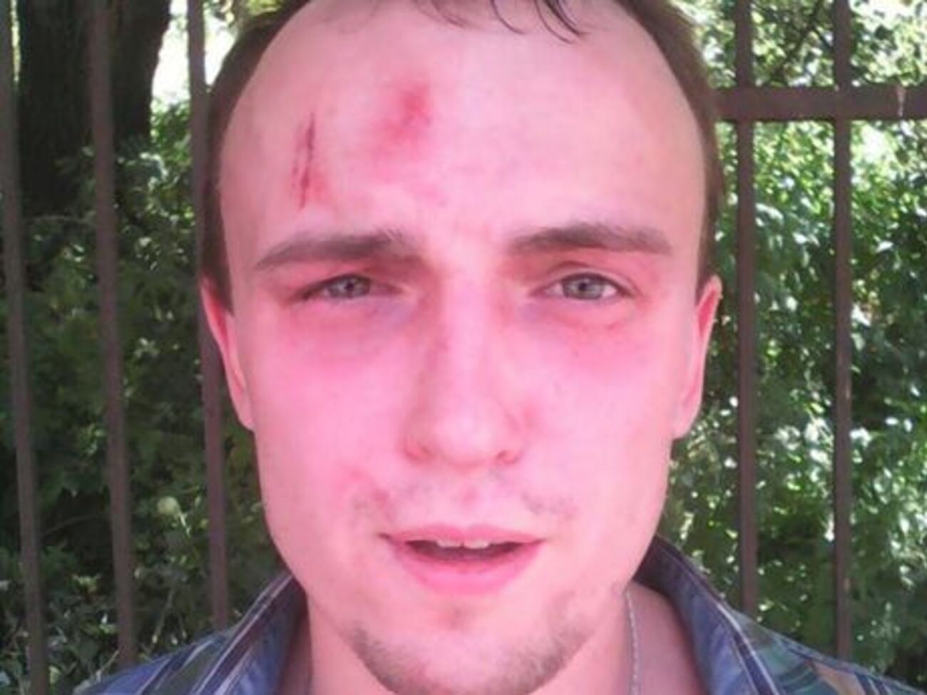 Денис Полищук после инцидента в УБОП Киева