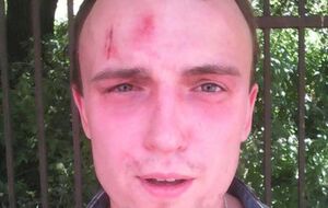 Денис Полищук после инцидента в УБОП Киева