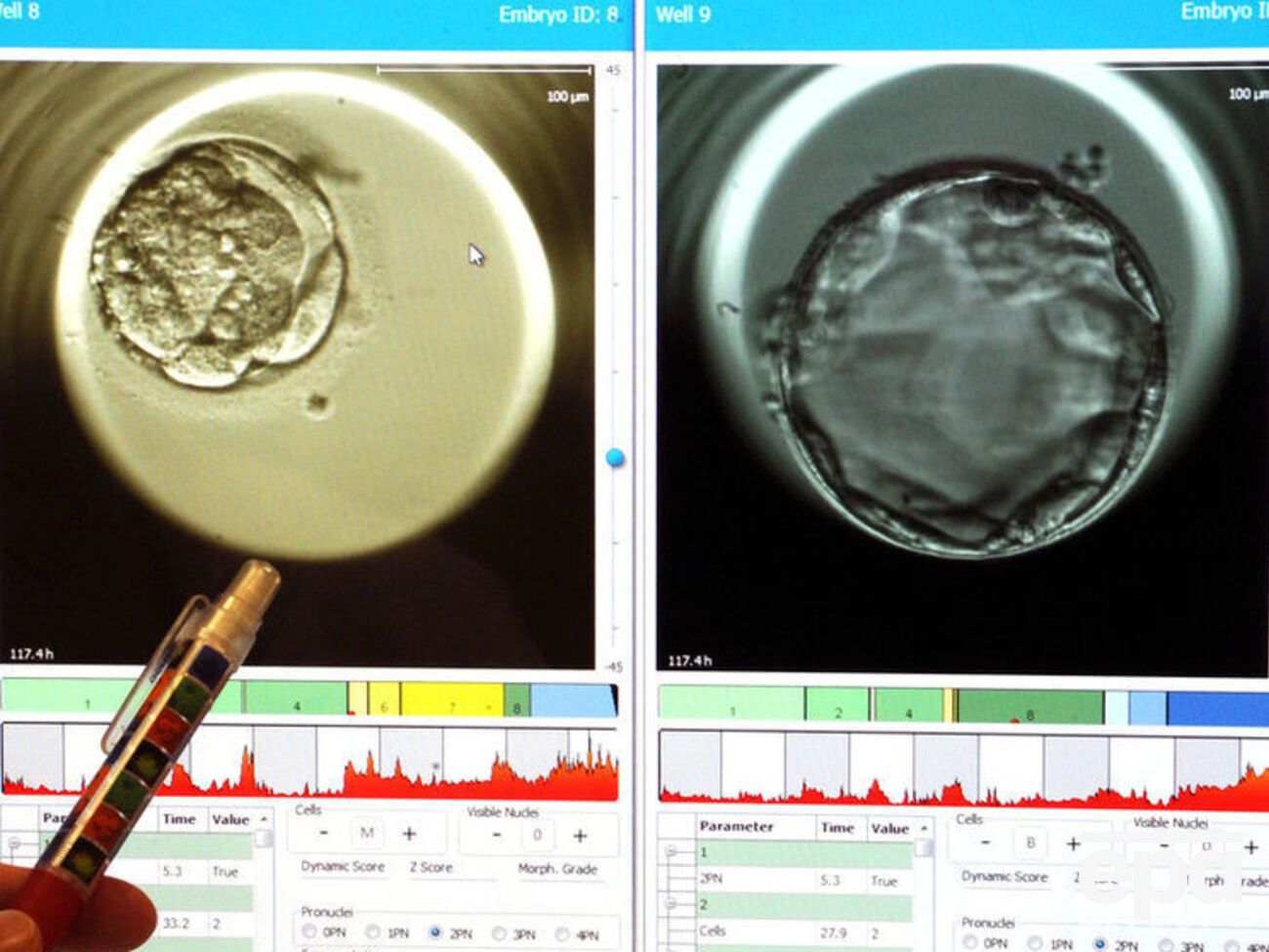 В мире уже живут несколько десятков людей, которые имеют митохондрии от донора