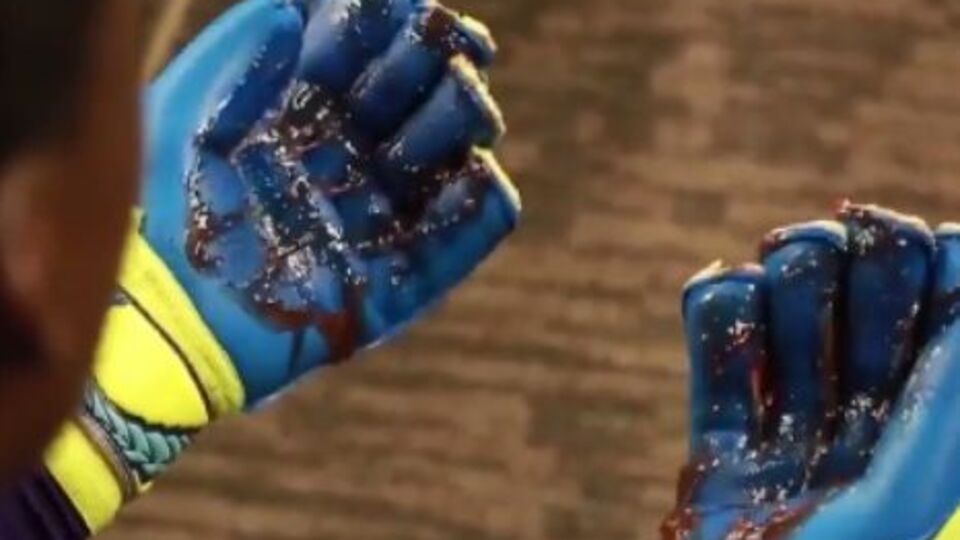 Голкипер вышел на поле, не вымыв перчатки