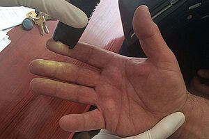 Врач требовал взятку за оказание медицинских услуг