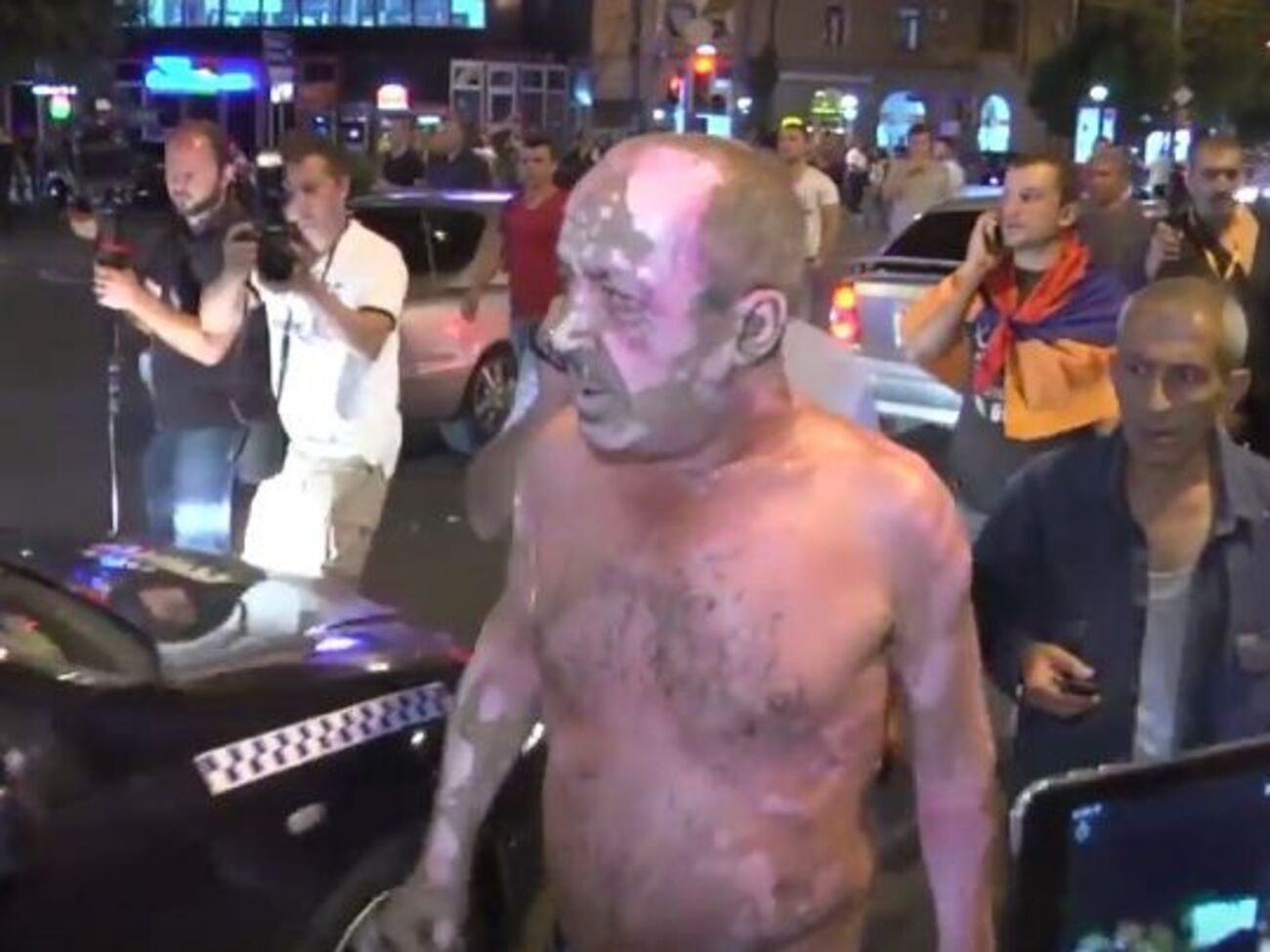 Пострадавший митингующий, пытавшийся поджечь себя