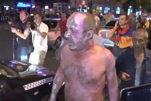 Пострадавший митингующий, пытавшийся поджечь себя