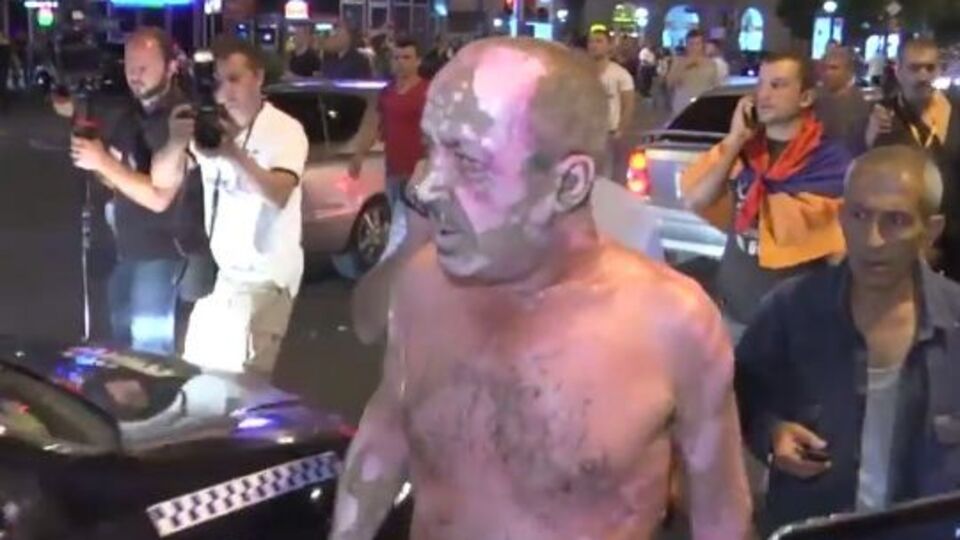 Пострадавший митингующий, пытавшийся поджечь себя