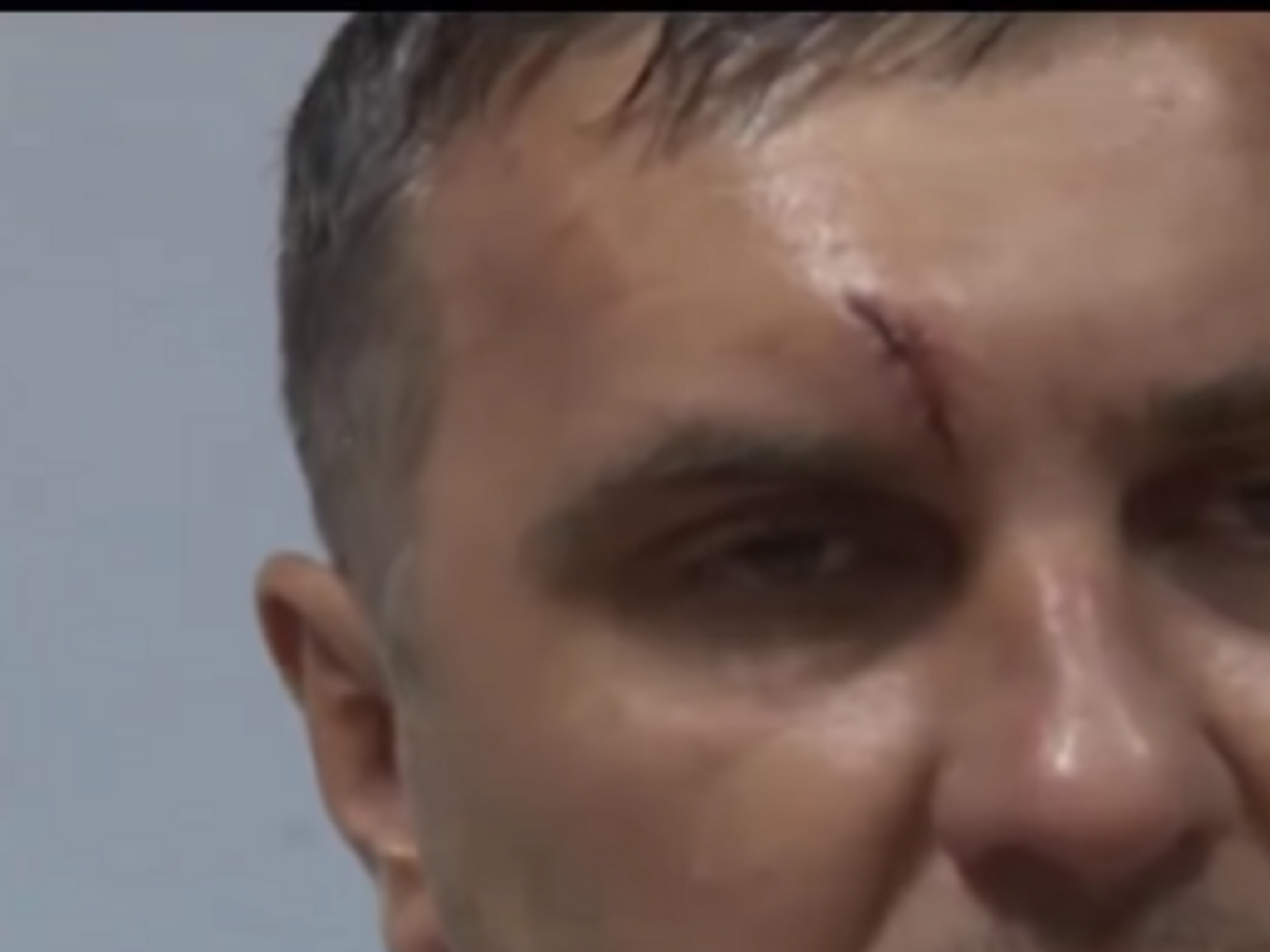 На лице Панова видны побои