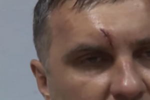 На лице Панова видны побои