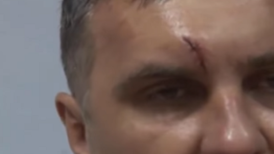 На лице Панова видны побои