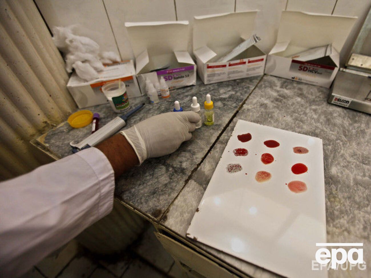 Распознать вирус Зика у двух граждан удалось путем исследований в лаборатории