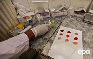 Распознать вирус Зика у двух граждан удалось путем исследований в лаборатории