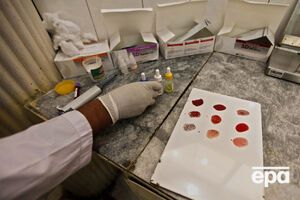 Распознать вирус Зика у двух граждан удалось путем исследований в лаборатории