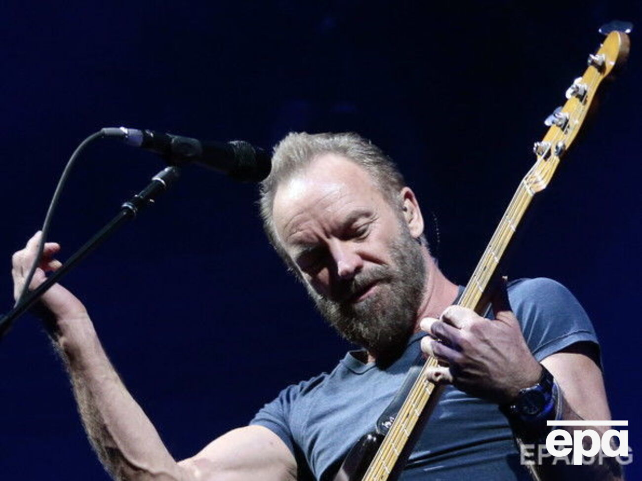 Сканирование мозга Стинга проводилось с помощью метода функциональной магнитно-резонансной томографии (ФМРТ)