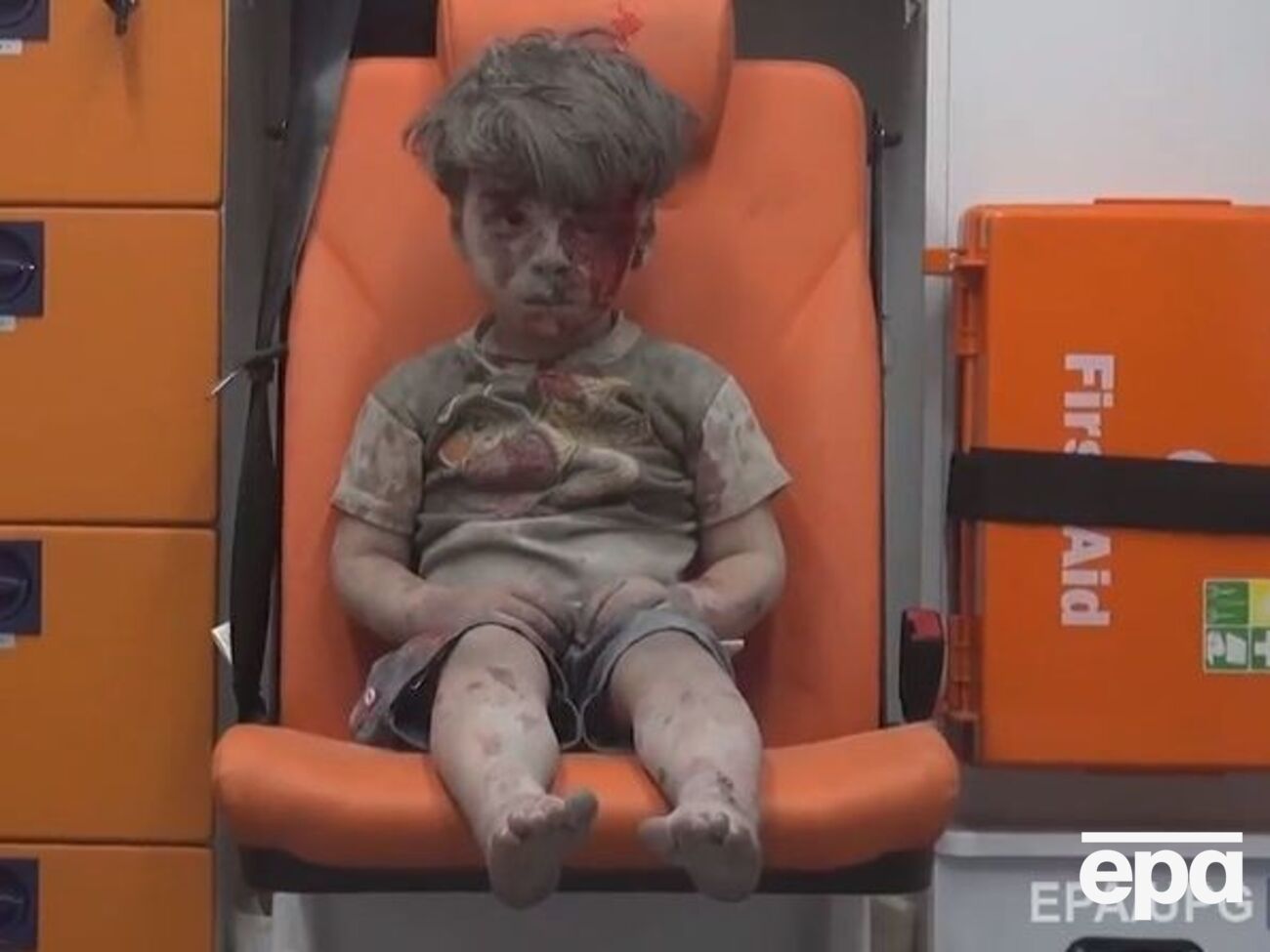 Маленький Омран потерял брата