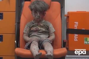 Маленький Омран потерял брата