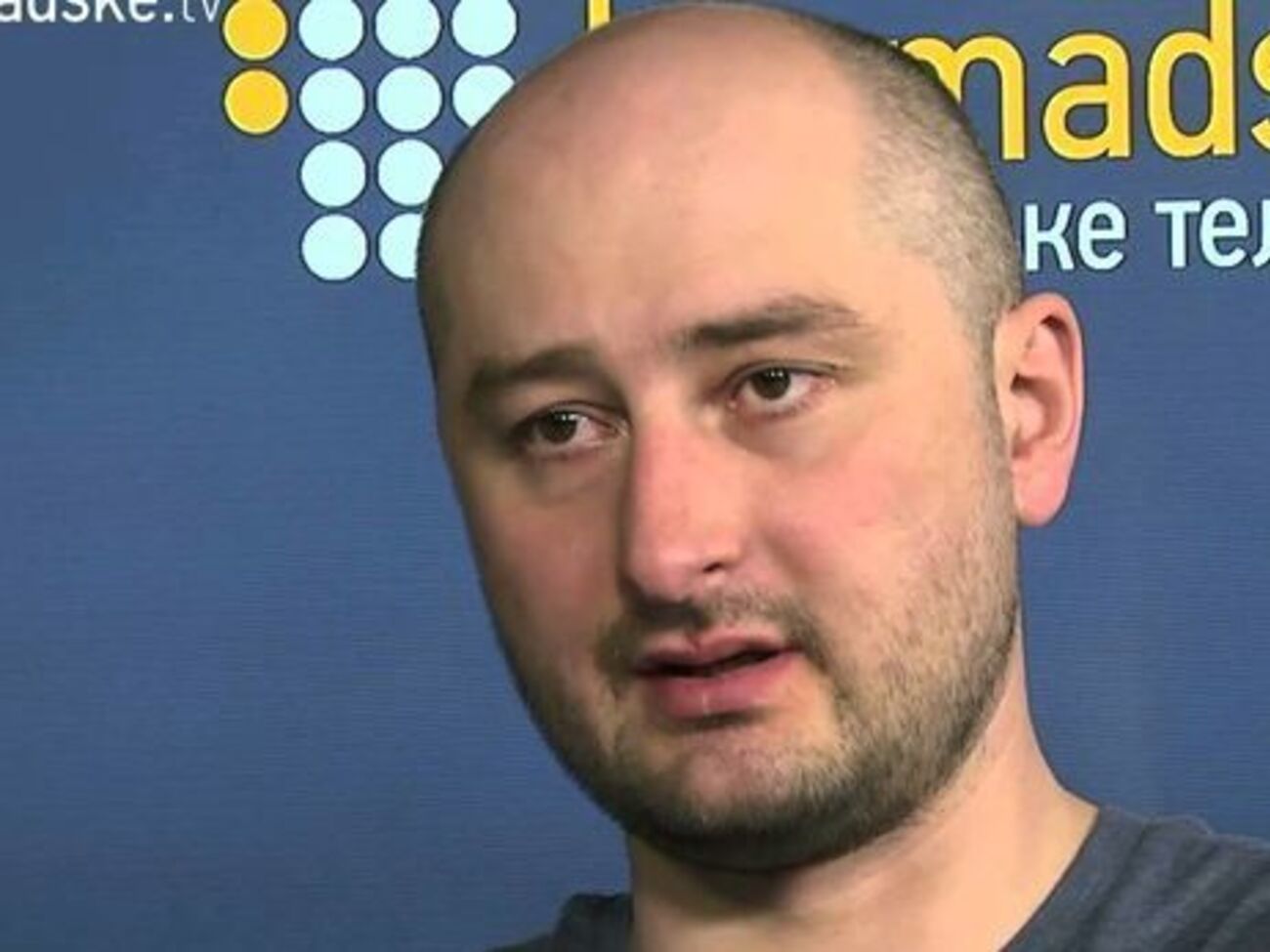 Бабченко: Подумаешь, мы на...бывали всех инвалидов во всем мире, вы не имеете права на...бать наших инвалидов, они же инвалиды!