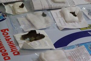 За время боевых действий на Донбассе врачи сделали более 3,5 тысяч операций